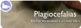 video_plagiocefalias